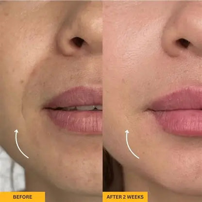 SculptLift™ Facial Massage Brush